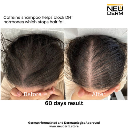 NeuDerm™ Caffeine Anti Hair Loss Shampoo